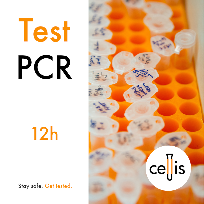 E-Kod Test genetyczny RT-PCR na obecność SARS-CoV-2 EKSPRESS